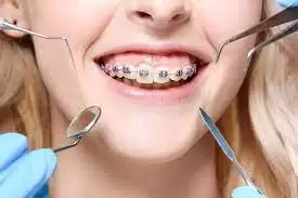 orthodontist Miami beach